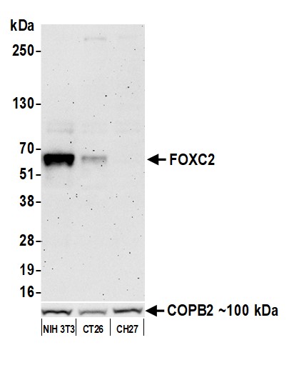 Western blot - Anti-FOXC2 antibody [BLR184J] - BSA free (AB314051), expandable thumbnail