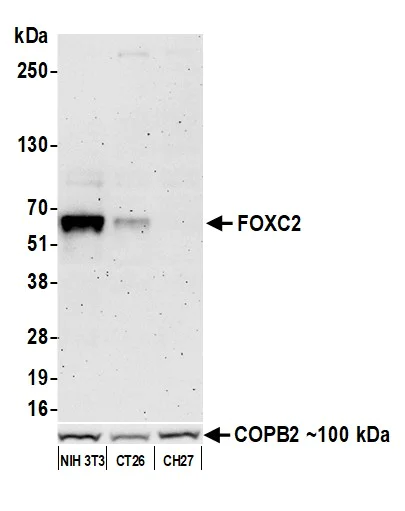 Western blot - Anti-FOXC2 antibody [BLR184J] - BSA free (AB314051)