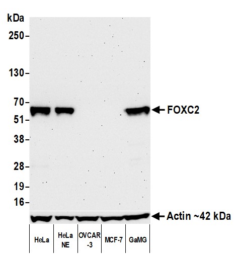Western blot - Anti-FOXC2 antibody [BLR184J] - BSA free (AB314051), expandable thumbnail