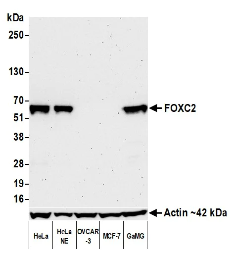 Western blot - Anti-FOXC2 antibody [BLR184J] - BSA free (AB314051)