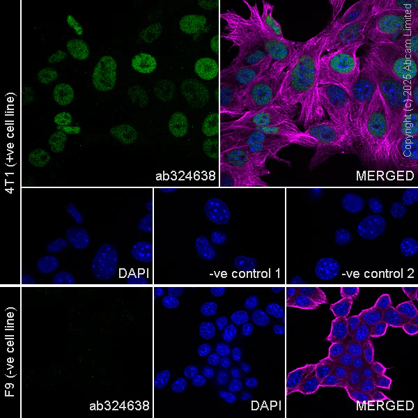 Immunocytochemistry/ Immunofluorescence - Anti-FOXC2 antibody [EPR29613-501] (AB324638)