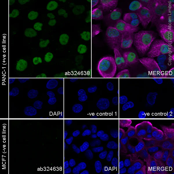 Immunocytochemistry/ Immunofluorescence - Anti-FOXC2 antibody [EPR29613-501] (AB324638)
