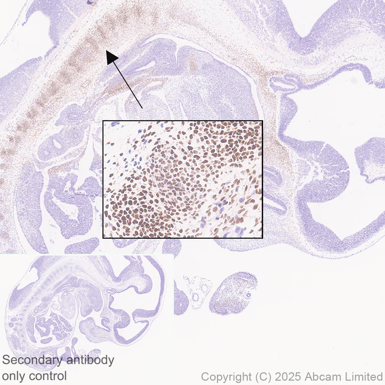 Immunohistochemistry (Formalin/PFA-fixed paraffin-embedded sections) - Anti-FOXC2 antibody [EPR29613-501] (AB324638)