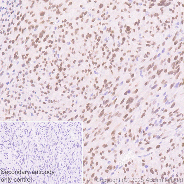 Immunohistochemistry (Formalin/PFA-fixed paraffin-embedded sections) - Anti-FOXC2 antibody [EPR29613-501] (AB324638)
