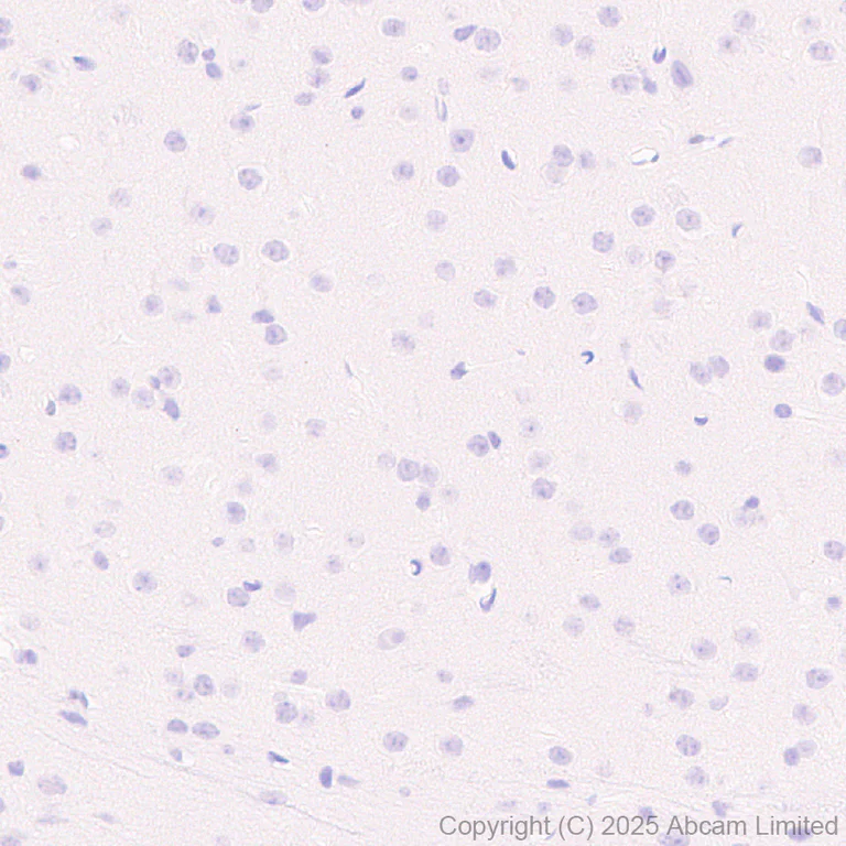 Immunohistochemistry (Formalin/PFA-fixed paraffin-embedded sections) - Anti-FOXC2 antibody [EPR29613-501] (AB324638)