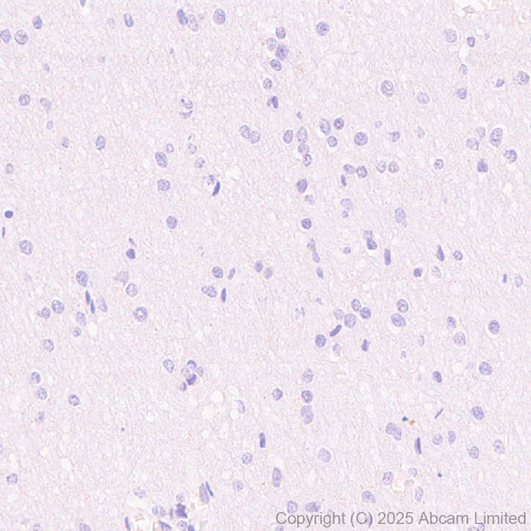 Immunohistochemistry (Formalin/PFA-fixed paraffin-embedded sections) - Anti-FOXC2 antibody [EPR29613-501] (AB324638)