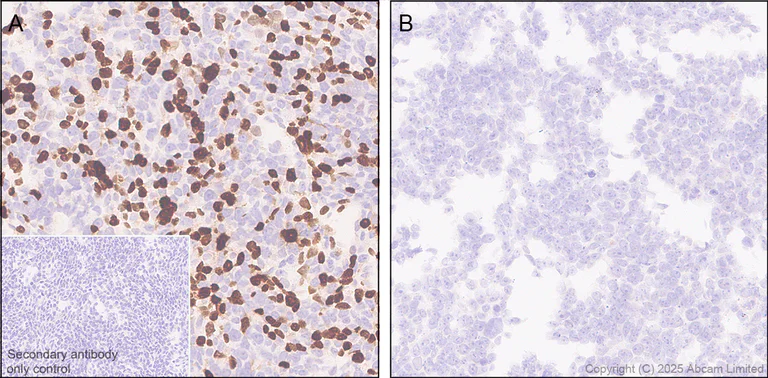 Immunohistochemistry (Formalin/PFA-fixed paraffin-embedded sections) - Anti-FOXC2 antibody [EPR29613-501] (AB324638)