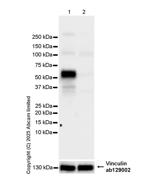 Western blot - Anti-FOXC2 antibody [EPR29613-501] (AB324638)