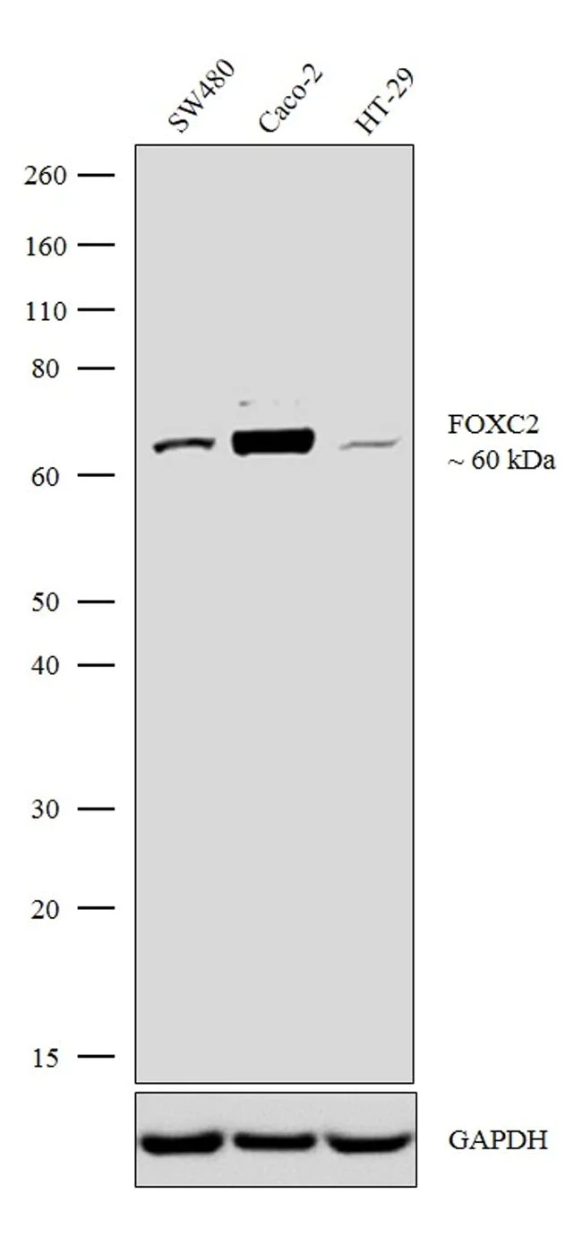 Western blot - Anti-FOXC2 antibody [RP23040265] - ChIP Grade (AB308055)