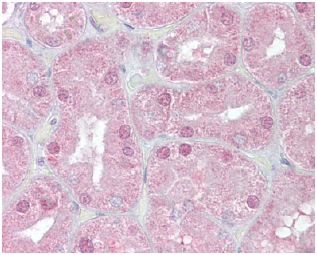 Immunohistochemistry (Formalin/PFA-fixed paraffin-embedded sections) - Anti-FOXD1/BF-2 antibody (AB129324)