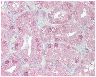 Immunohistochemistry (Formalin/PFA-fixed paraffin-embedded sections) - Anti-FOXD1/BF-2 antibody (AB129324)