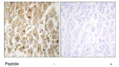 Immunohistochemistry (Formalin/PFA-fixed paraffin-embedded sections) - Anti-FOXD3 antibody (AB64807)