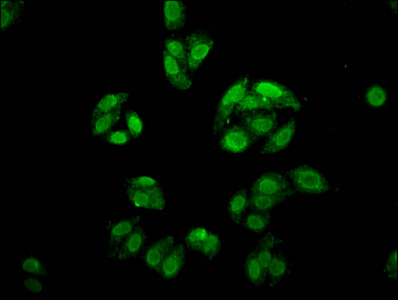 Immunocytochemistry/ Immunofluorescence - Anti-FOXE3 antibody (AB237030), expandable thumbnail