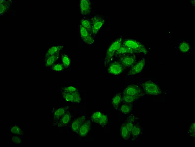 Immunocytochemistry/ Immunofluorescence - Anti-FOXE3 antibody (AB237030)