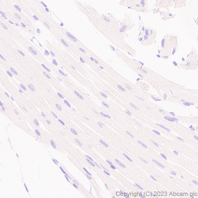 Immunohistochemistry (Formalin/PFA-fixed paraffin-embedded sections) - Anti-FOXF1 antibody [EPR27368-79] (AB308633), expandable thumbnail