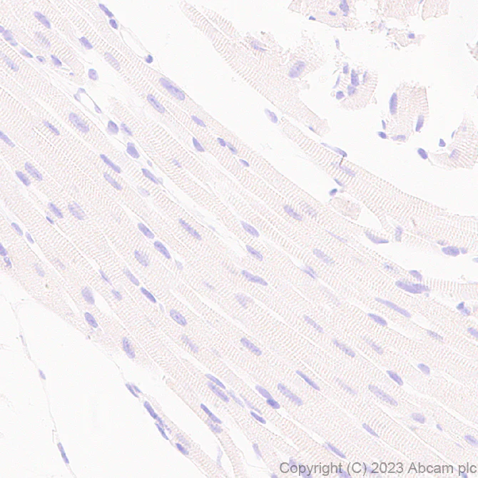 Immunohistochemistry (Formalin/PFA-fixed paraffin-embedded sections) - Anti-FOXF1 antibody [EPR27368-79] (AB308633)