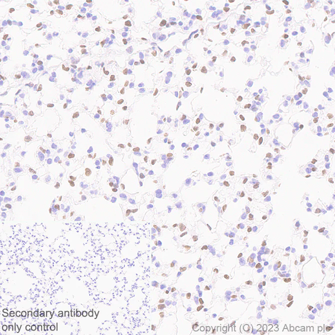 Immunohistochemistry (Formalin/PFA-fixed paraffin-embedded sections) - Anti-FOXF1 antibody [EPR27368-79] (AB308633)