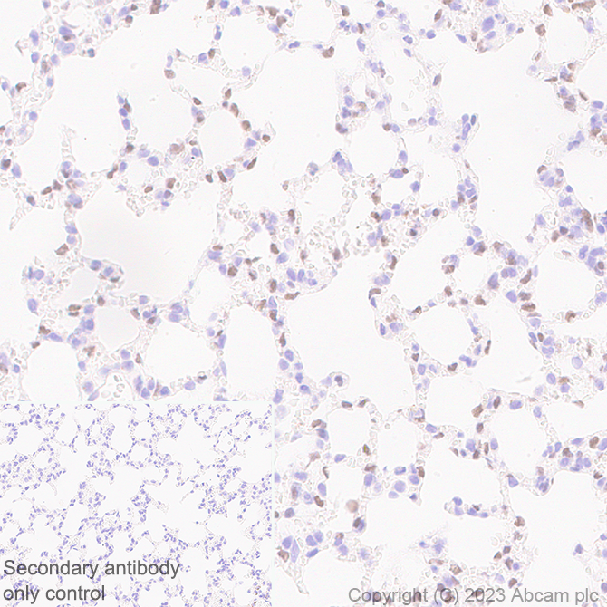 Immunohistochemistry (Formalin/PFA-fixed paraffin-embedded sections) - Anti-FOXF1 antibody [EPR27368-79] (ab308633), expandable thumbnail