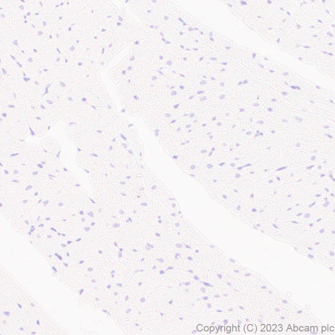 Immunohistochemistry (Formalin/PFA-fixed paraffin-embedded sections) - Anti-FOXF1 antibody [EPR27368-79] - BSA and Azide free (AB308634)