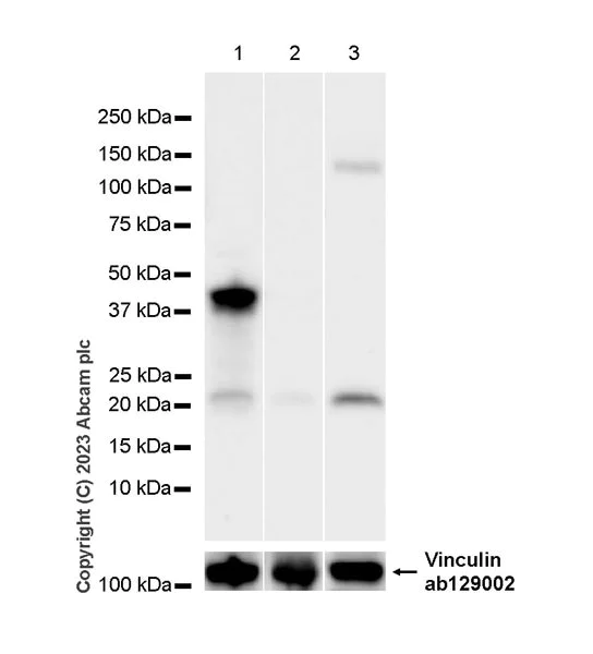 Western blot - Anti-FOXF1 antibody [EPR27368-79] - BSA and Azide free (AB308634)