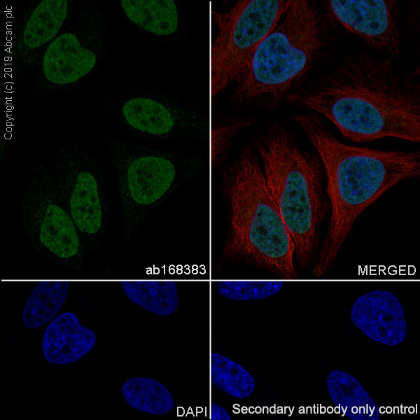 Immunocytochemistry/ Immunofluorescence - Anti-FOXF1 antibody [EPR7971] (AB168383), expandable thumbnail