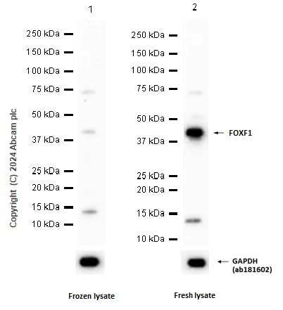 Western blot - Anti-FOXF1 antibody [EPR7971] - BSA and Azide free (AB240153)