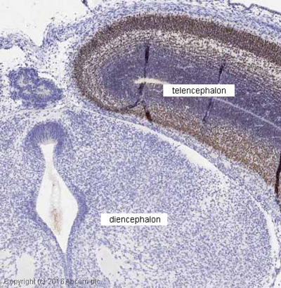 Immunohistochemistry (Formalin/PFA-fixed paraffin-embedded sections) - Anti-FOXG1 antibody (AB18259), expandable thumbnail