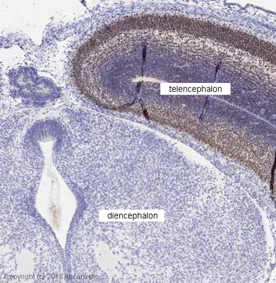 Immunohistochemistry (Formalin/PFA-fixed paraffin-embedded sections) - Anti-FOXG1 antibody (AB18259)