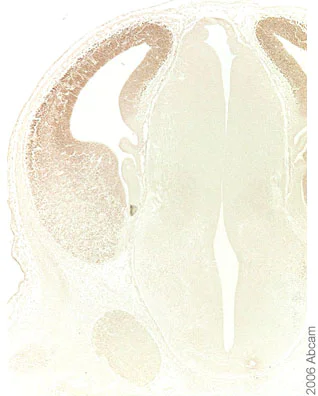 Immunohistochemistry (Formalin/PFA-fixed paraffin-embedded sections) - Anti-FOXG1 antibody (AB18259)