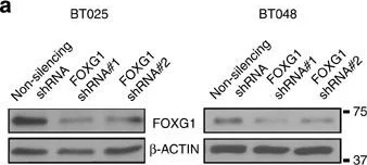 Western blot - Anti-FOXG1 antibody (AB18259)