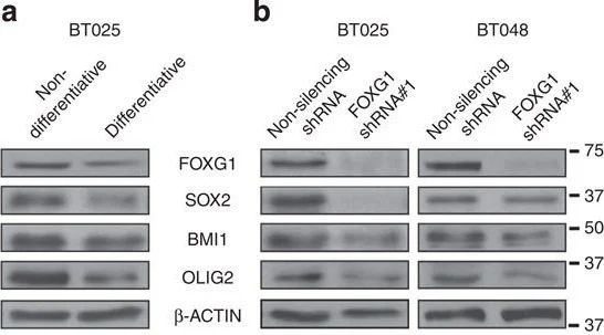 Western blot - Anti-FOXG1 antibody (AB18259)