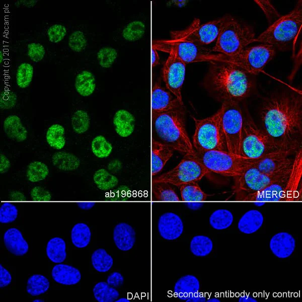 Immunocytochemistry/ Immunofluorescence - Anti-FOXG1 antibody [EPR18987] (AB196868)