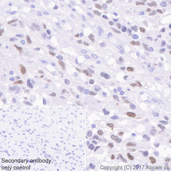 Immunohistochemistry (Formalin/PFA-fixed paraffin-embedded sections) - Anti-FOXG1 antibody [EPR18987] (AB196868)