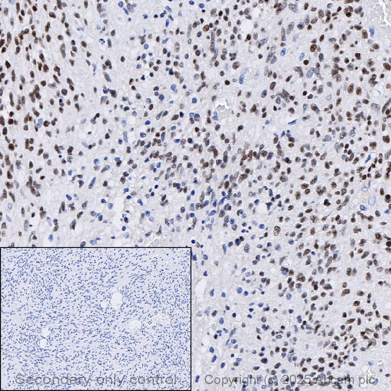 Immunohistochemistry (Formalin/PFA-fixed paraffin-embedded sections) - Anti-FOXG1 antibody [EPR18987] (AB196868)