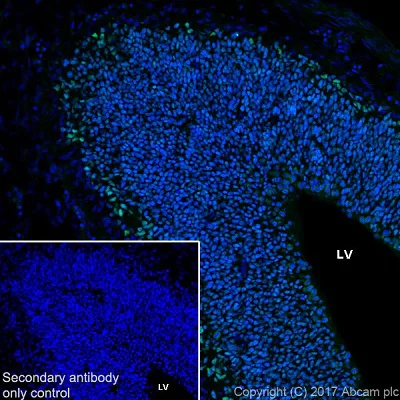 Immunohistochemistry (Frozen sections) - Anti-FOXG1 antibody [EPR18987] (AB196868)