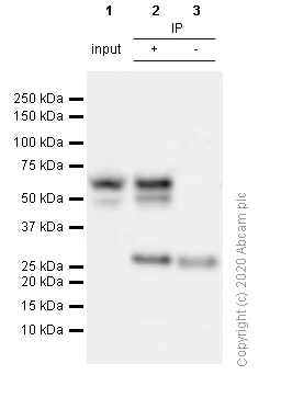 Immunoprecipitation - Anti-FOXG1 antibody [EPR18987] (AB196868)