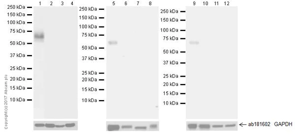 Western blot - Anti-FOXG1 antibody [EPR18987] (AB196868)