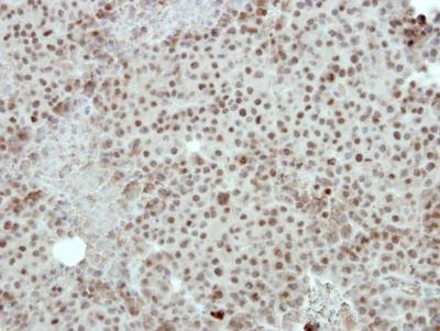 Immunohistochemistry (Formalin/PFA-fixed paraffin-embedded sections) - Anti-FOXI1 antibody (AB153935), expandable thumbnail