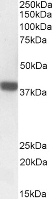 Western blot - Anti-FOXI3 antibody (AB113424), expandable thumbnail