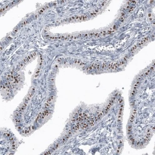 Immunohistochemistry (Formalin/PFA-fixed paraffin-embedded sections) - Anti-FoxJ1 antibody [CL3989] (AB220028)