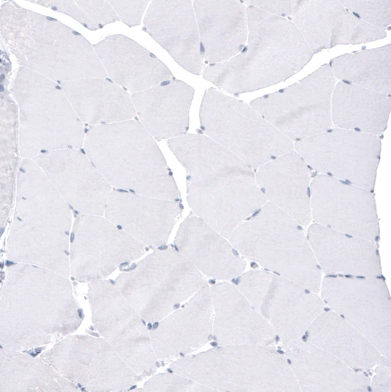Immunohistochemistry (Formalin/PFA-fixed paraffin-embedded sections) - Anti-FoxJ1 antibody [CL3989] (AB220028)