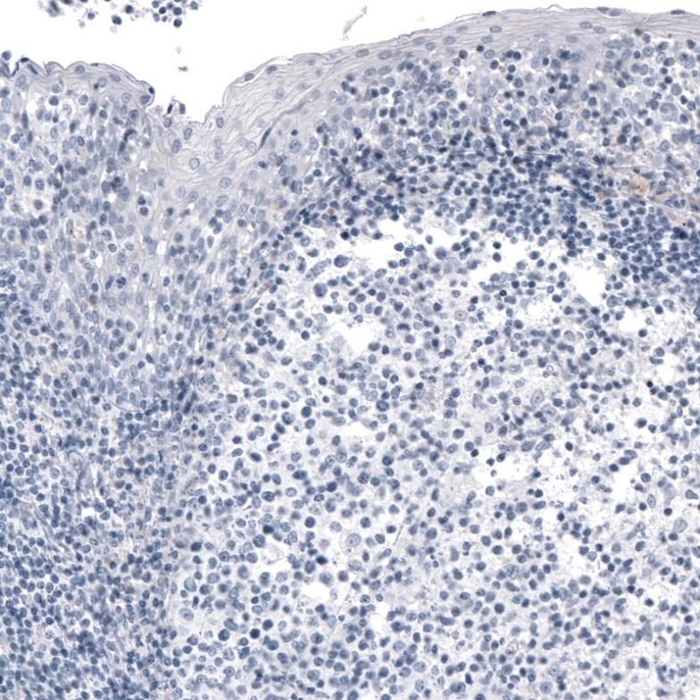 Immunohistochemistry (Formalin/PFA-fixed paraffin-embedded sections) - Anti-FoxJ1 antibody [CL3989] (AB220028)