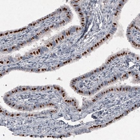 Immunohistochemistry (Formalin/PFA-fixed paraffin-embedded sections) - Anti-FoxJ1 antibody [CL3991] (AB220029)