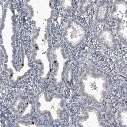 Immunohistochemistry (Formalin/PFA-fixed paraffin-embedded sections) - Anti-FoxJ1 antibody [CL3991] (AB220029)