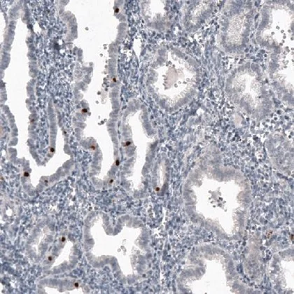 Immunohistochemistry (Formalin/PFA-fixed paraffin-embedded sections) - Anti-FoxJ1 antibody [CL3991] (AB220029)