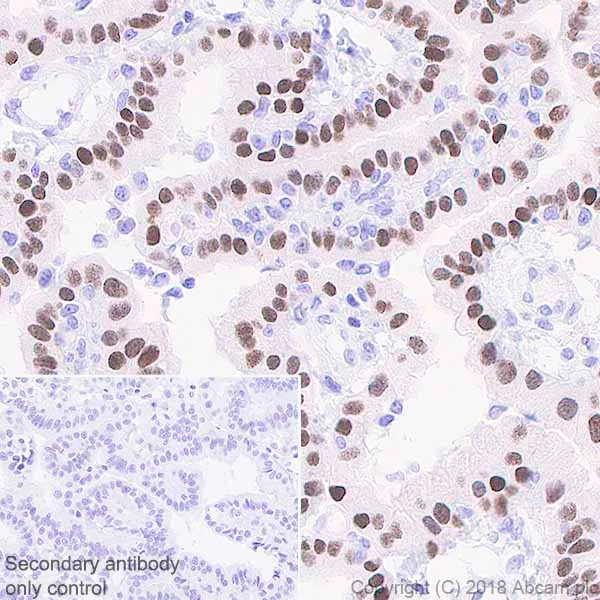 Immunohistochemistry (Formalin/PFA-fixed paraffin-embedded sections) - Anti-FoxJ1 antibody [EPR21874] (AB235445)
