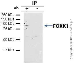 Immunoprecipitation - Anti-FOXK1/MNF antibody (AB18196)