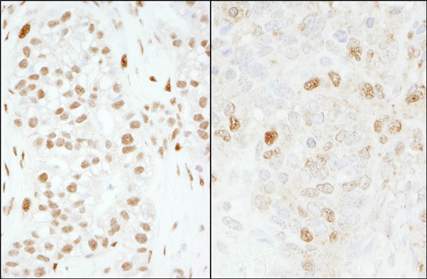 Immunohistochemistry (Formalin/PFA-fixed paraffin-embedded sections) - Anti-FOXK1/MNF antibody (AB85999)