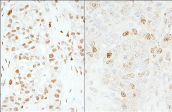Immunohistochemistry (Formalin/PFA-fixed paraffin-embedded sections) - Anti-FOXK1/MNF antibody (AB85999)