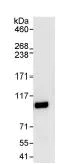 Immunoprecipitation - Anti-FOXK1/MNF antibody (AB85999)